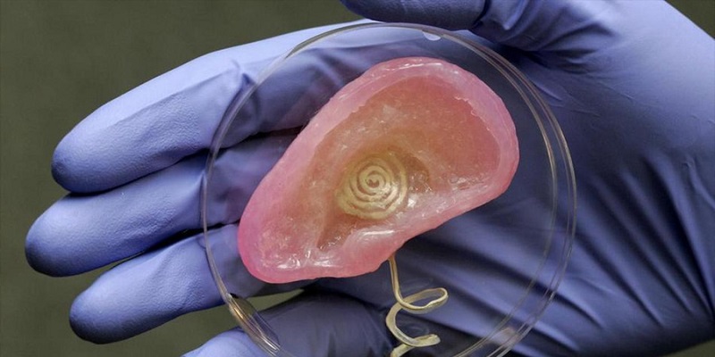 ¿Qué decir de la clonación de organos humanos?